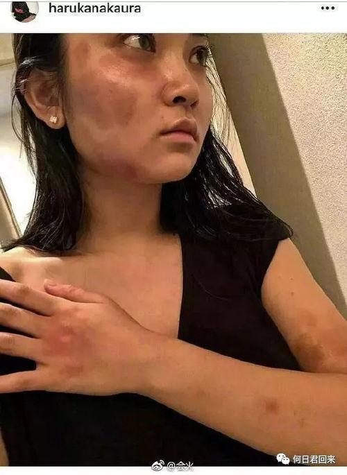 发吃瓜视频会怎么样,发布吃瓜视频背后的惊人效应